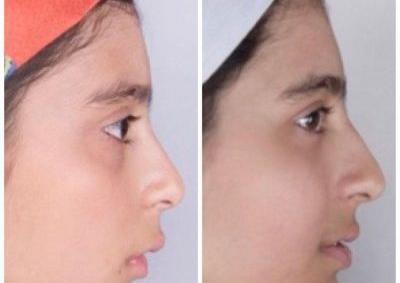 عکس فاطمه تیموری