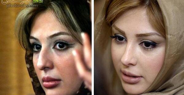 عکس سوگند قبل عمل