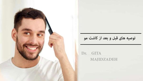 عکس قبل کاشت مو