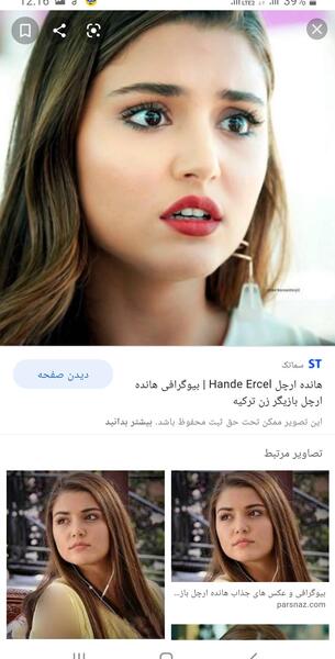 عکس هانده قبل از عمل