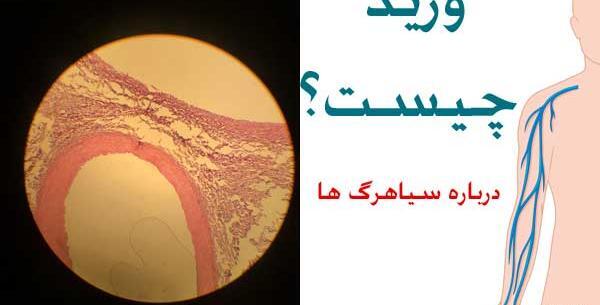 عکس سیاهرگ