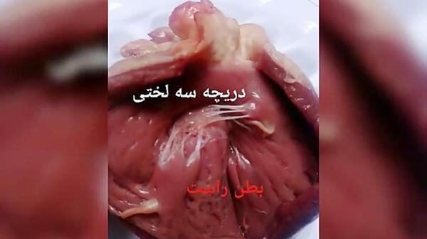 عکس قلب زیست دهم