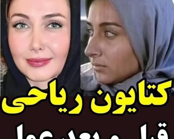 عکس زلیخا قبل عمل زیبایی