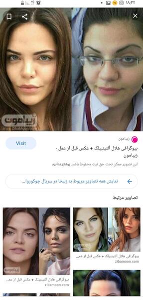 عکس زلیخا قبل عمل زیبایی