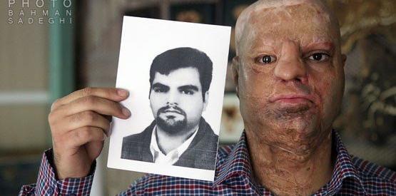 عکس مرد چاقو خورده
