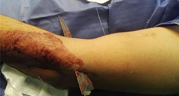 عکس مرد چاقو خورده