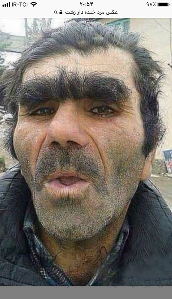عکس مرد زشت
