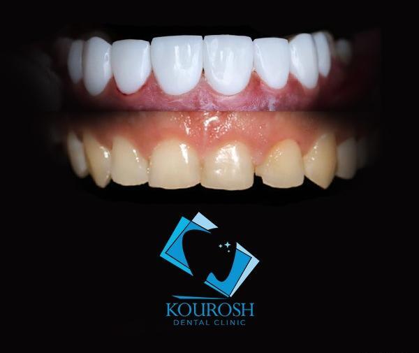 عکس طرح لبخند زیبا
