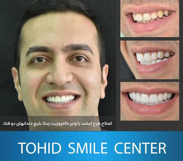 عکس طرح لبخند زیبا