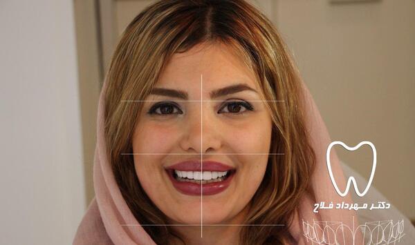 عکس طرح لبخند زیبا
