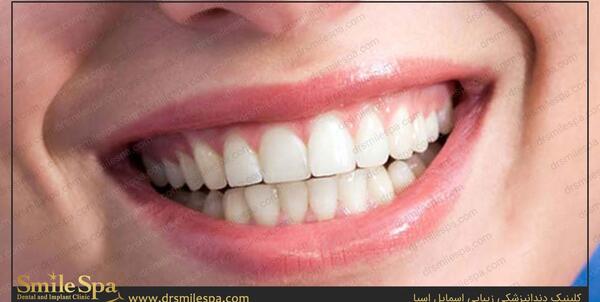 عکس لبخند دندان