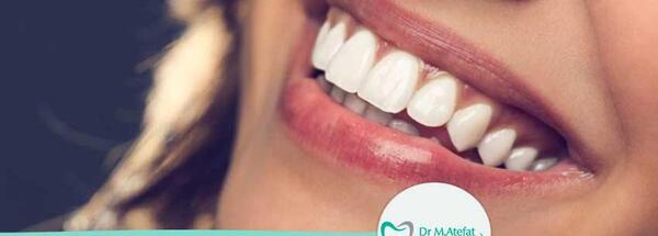 عکس لبخند دندان