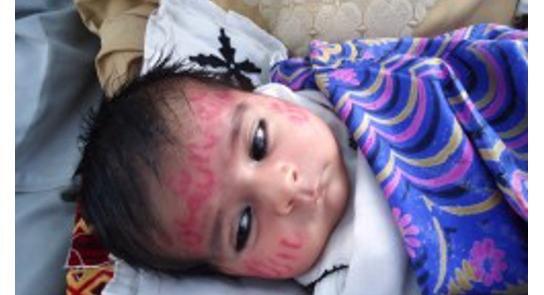 عکس نوزاد افغانی