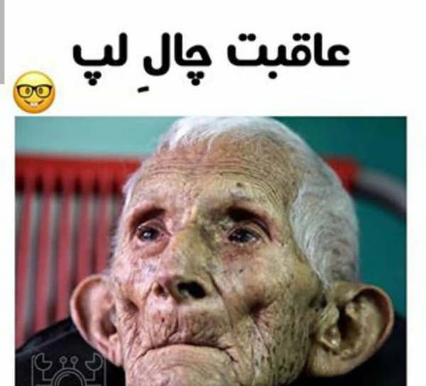 عکس طنز چال گونه