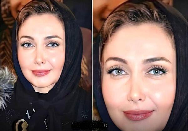 عکس زلیخا قبل از جراحی