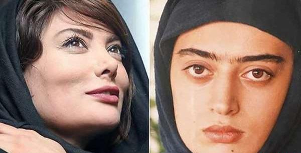 عکس زلیخا قبل از جراحی