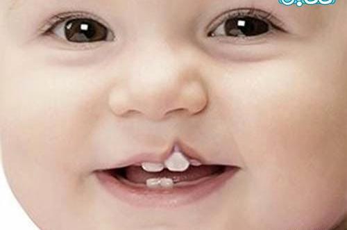 عکس ماه گرفتگی صورت