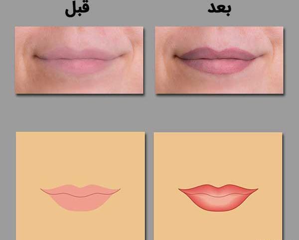 عکس تاتو خط لب کالباسی