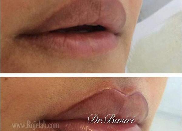 عکس تاتو خط لب کالباسی