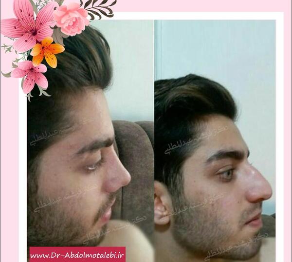 عکس مردان دماغ عملی