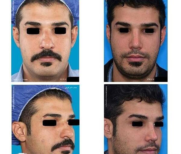 عکس مردان دماغ عملی