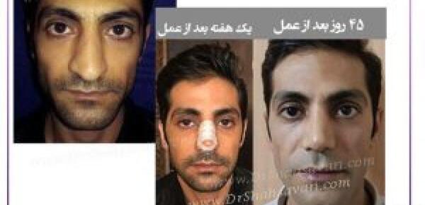 عکس مردان دماغ عملی
