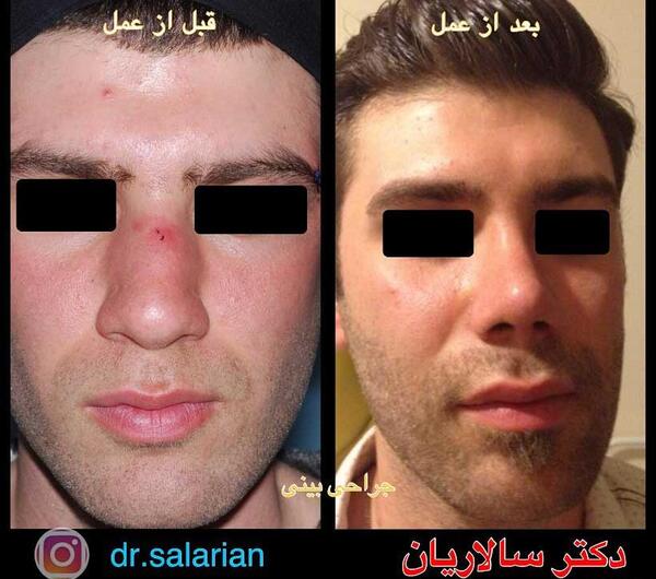 عکس مردان دماغ عملی