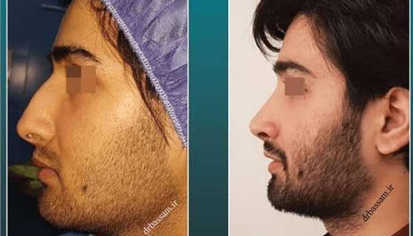 عکس مردان دماغ عملی