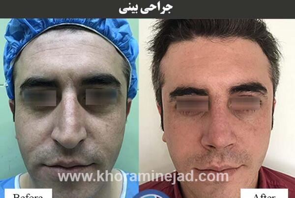 عکس مردان دماغ عملی
