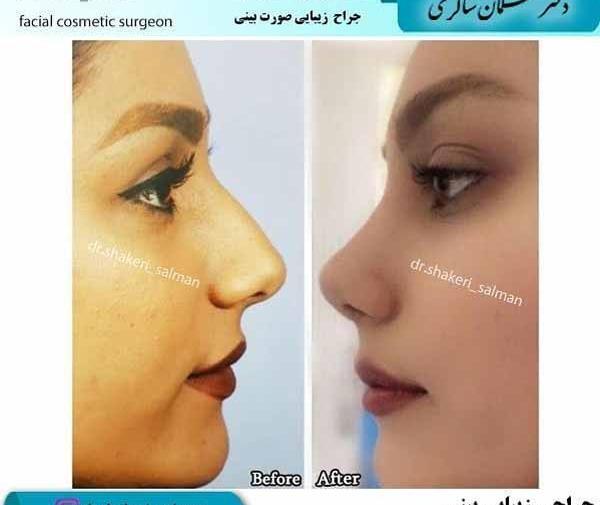 عکس مردان دماغ عملی