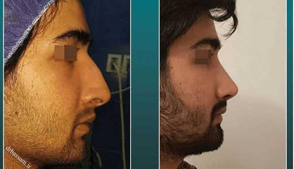عکس مردان دماغ عملی