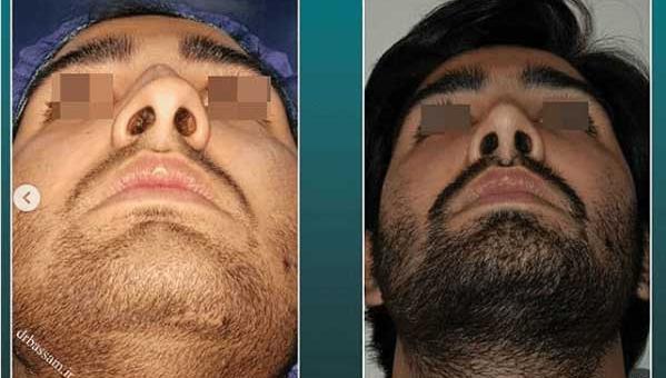 عکس مردان دماغ عملی