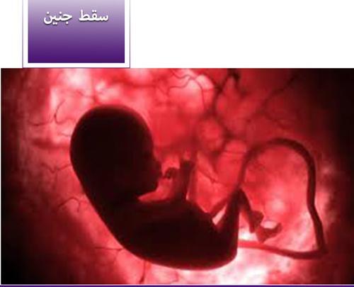سقط جنین عکس لکه بینی در بارداری