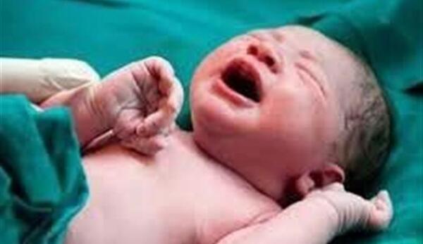 عکس نوزاد یه روزه