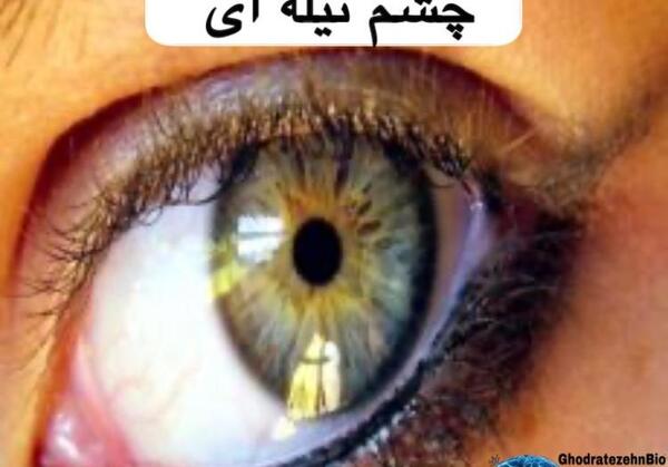 عکس چشم تیله ای