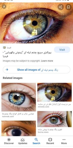 عکس چشم تیله ای