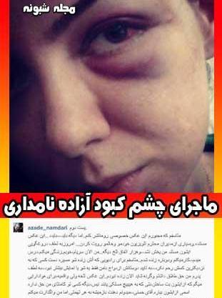 عکس چشم کبود آزاده نامداری