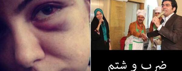 عکس چشم کبود آزاده نامداری
