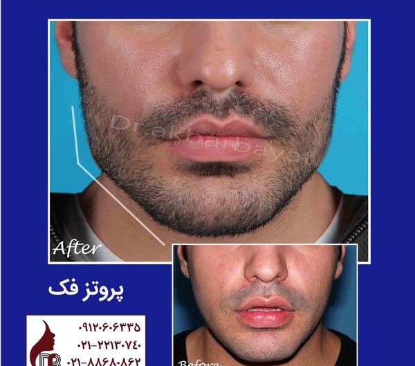 عکس عرفان فاتح