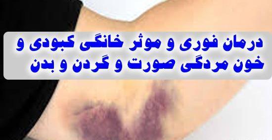 عکس عاشقانه کبودی گردن