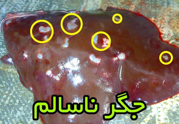 عکس جگر سفید سالم