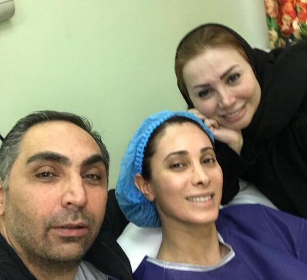 عکس زیبا کرمعلی قبل از عمل