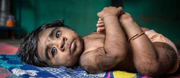 عکس ترسناک گرگ