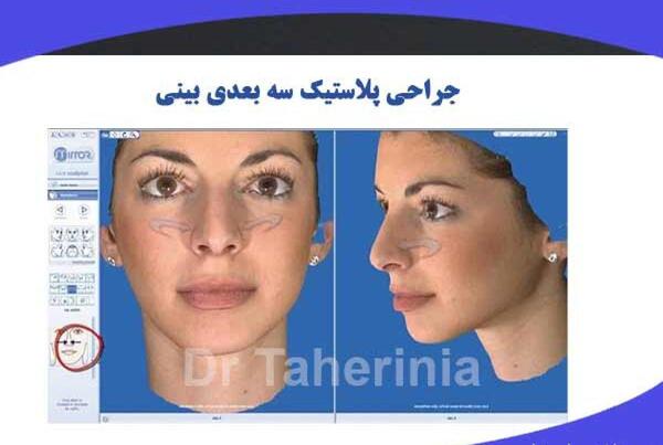 عکس سه بعدی قبل عمل بینی