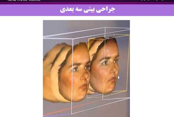 عکس سه بعدی قبل عمل بینی