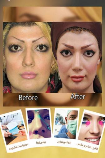عکس سه بعدی قبل عمل بینی