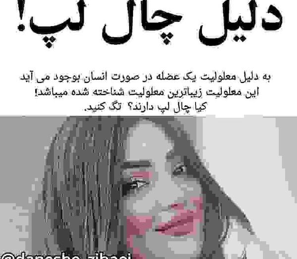 عکس دختر زیبا با چال گونه