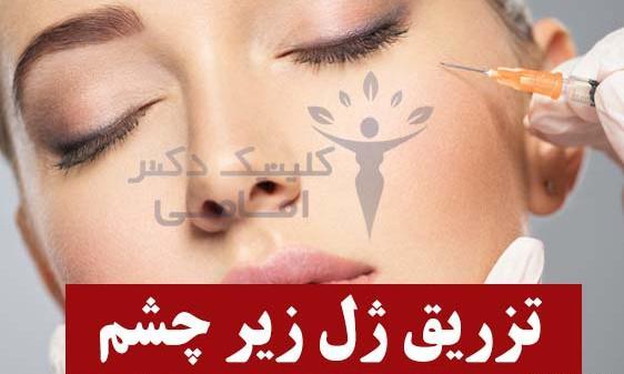 عکس ژل چشم