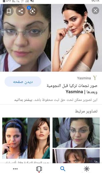 عکس قبل از عمل زلیخا