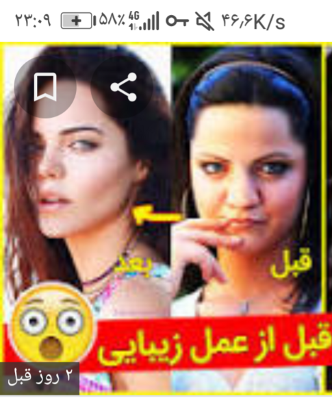 عکس قبل از عمل زلیخا